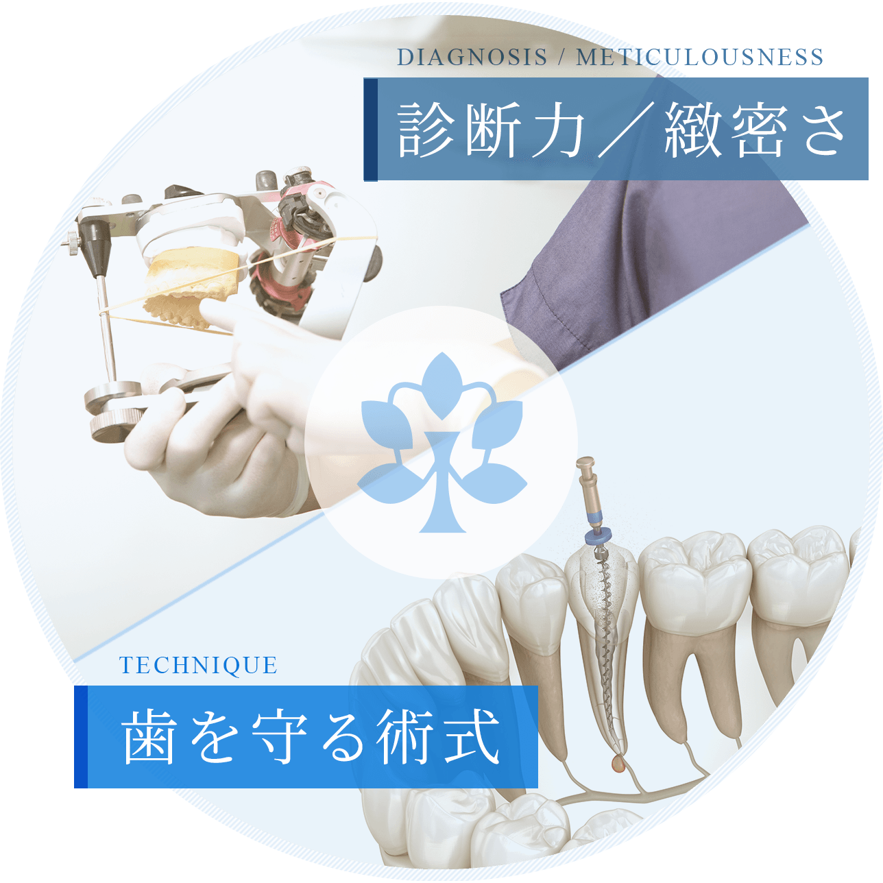 診断力/緻密さ 歯を守る術式
