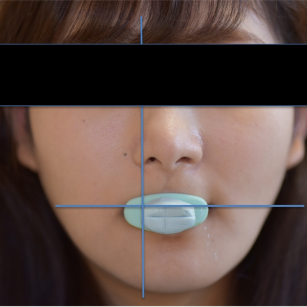 セントリックトレー